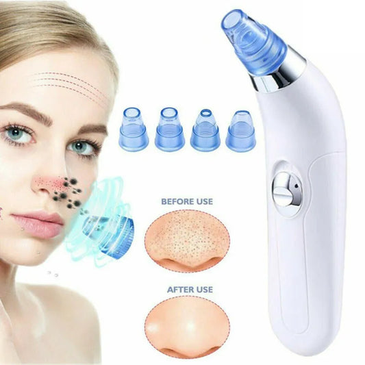 Electric Pore Cleaning Device Blackhead Remover for Deep Facial Cleansing - SouqFinds- Electric Pore Cleaning Device Blackhead Remover for Deep Facial Cleansing- Electric Pore Cleaning Device Blackhead Remover for Deep Facial Cleansing